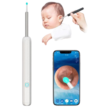Earwax Removal Kit– Smart Visual Earwax Removal Tool 👂📱